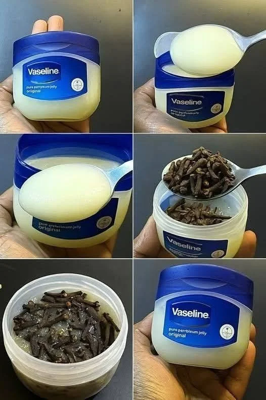 Clove and petroleum jelly salve as a natural remedy for skin health