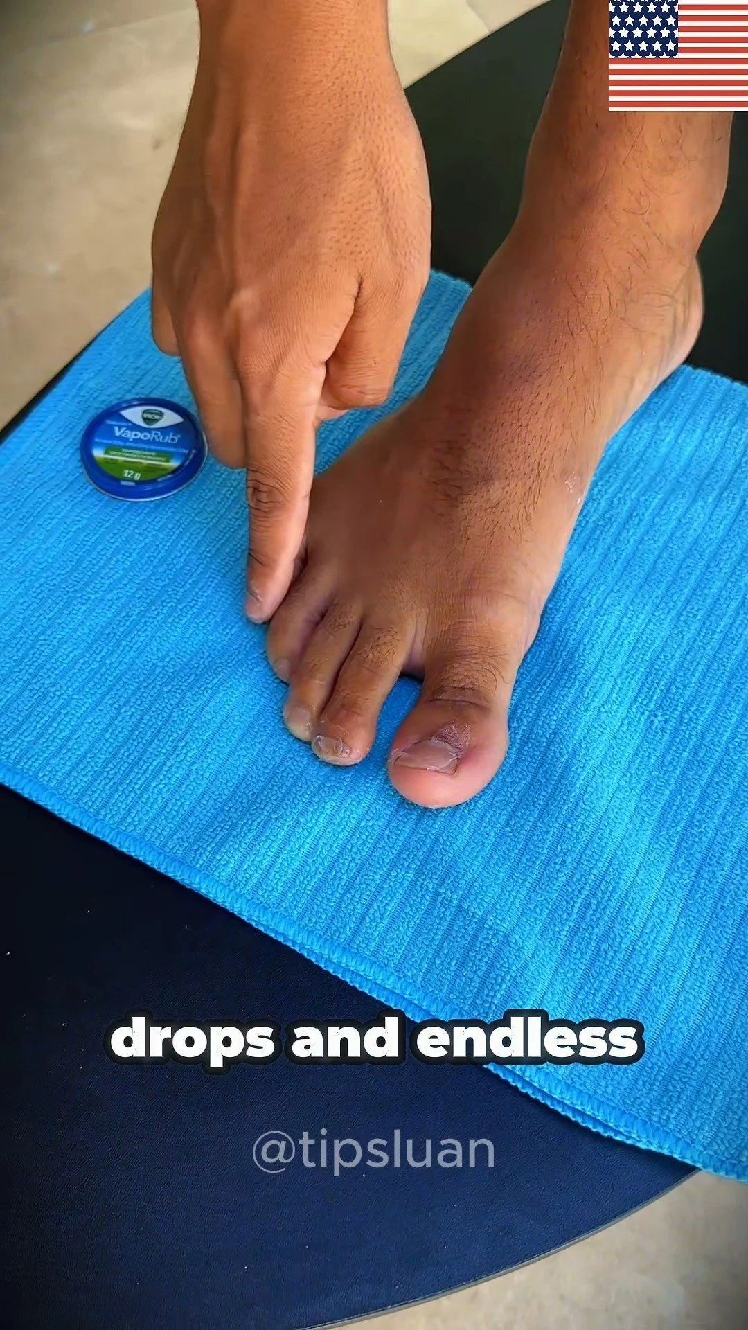 Treating nail fungus with Vicks method for healthier nails