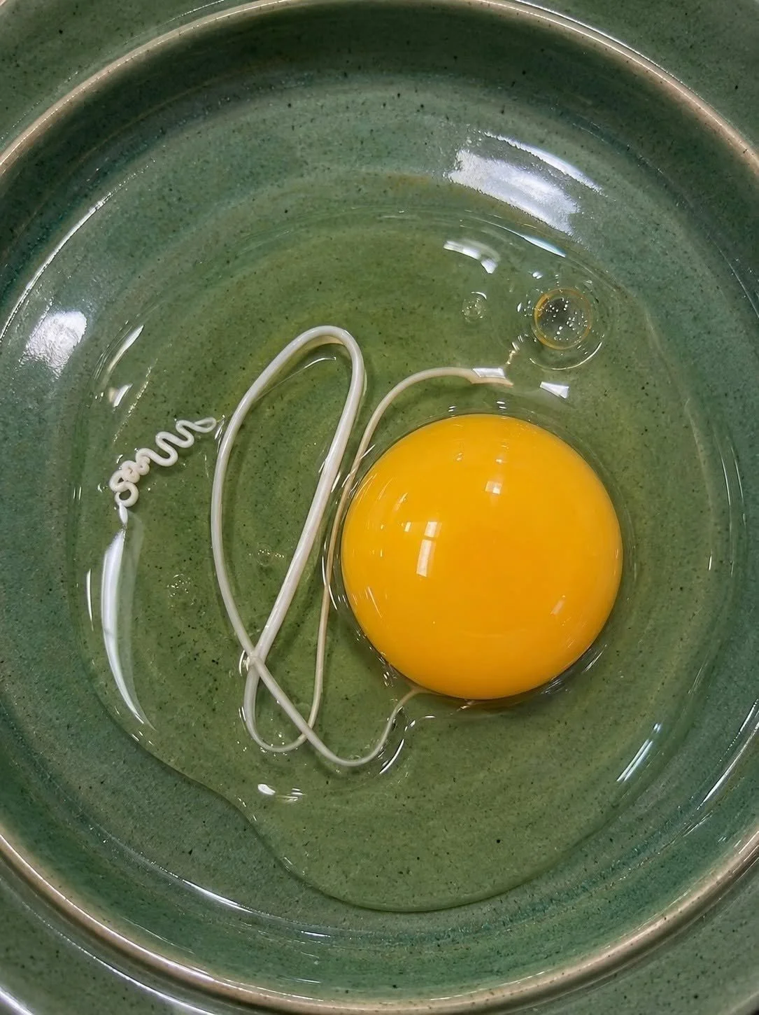 The White String in Egg: Not Dangerous After All